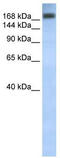Double-stranded RNA-specific adenosine deaminase antibody, TA341713, Origene, Western Blot image 