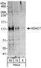 Histone Deacetylase 7 antibody, A301-385A, Bethyl Labs, Western Blot image 