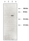 Matrix Metallopeptidase 2 antibody, TA353336L, Origene, Western Blot image 