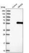 Abhydrolase Domain Containing 8 antibody, NBP1-83728, Novus Biologicals, Western Blot image 