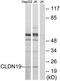 Claudin 19 antibody, TA316160, Origene, Western Blot image 