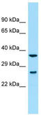 Synaptonemal Complex Central Element Protein 2 antibody, TA334098, Origene, Western Blot image 