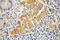 Mitochondrial tRNA-specific 2-thiouridylase 1 antibody, 14970-1-AP, Proteintech Group, Immunohistochemistry paraffin image 