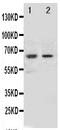 NADPH Oxidase 1 antibody, PA1739, Boster Biological Technology, Western Blot image 