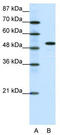 Spi-B Transcription Factor antibody, TA329275, Origene, Western Blot image 