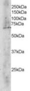 Transducin Beta Like 1 X-Linked antibody, NB300-872, Novus Biologicals, Western Blot image 
