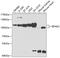Eukaryotic Translation Initiation Factor 4 Gamma 2 antibody, 18-858, ProSci, Western Blot image 