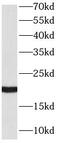 Rac Family Small GTPase 2 antibody, FNab07069, FineTest, Western Blot image 