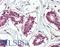 Insulin Like Growth Factor 2 MRNA Binding Protein 1 antibody, LS-B8333, Lifespan Biosciences, Immunohistochemistry paraffin image 