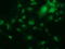 RB Binding Protein 9, Serine Hydrolase antibody, TA501677, Origene, Immunofluorescence image 