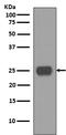Thy-1 Cell Surface Antigen antibody, M01818, Boster Biological Technology, Western Blot image 