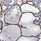 Zinc Finger And BTB Domain Containing 14 antibody, HPA050758, Atlas Antibodies, Immunohistochemistry frozen image 