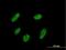 VENT Homeobox antibody, H00027287-B01P, Novus Biologicals, Immunocytochemistry image 
