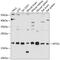 AP2S1 antibody, GTX65527, GeneTex, Western Blot image 