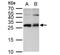 ETHE1 Persulfide Dioxygenase antibody, NBP2-16384, Novus Biologicals, Western Blot image 