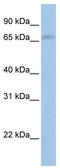 Mitogen-Activated Protein Kinase Kinase Kinase 2 antibody, TA331028, Origene, Western Blot image 
