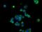 Basigin (Ok Blood Group) antibody, NBP2-02534, Novus Biologicals, Immunocytochemistry image 