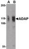 ADAP antibody, PA5-20401, Invitrogen Antibodies, Western Blot image 