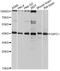 GIPC PDZ Domain Containing Family Member 1 antibody, A10550, ABclonal Technology, Western Blot image 