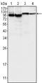 Bruton Tyrosine Kinase antibody, STJ97885, St John
