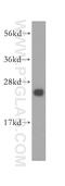 EEF1A Lysine Methyltransferase 1 antibody, 16954-1-AP, Proteintech Group, Western Blot image 