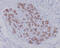 Aquaporin 1 (Colton Blood Group) antibody, M00865, Boster Biological Technology, Immunohistochemistry paraffin image 