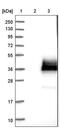 Serine Peptidase Inhibitor, Kunitz Type 2 antibody, PA5-52790, Invitrogen Antibodies, Western Blot image 