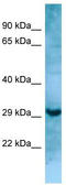 Mannan-binding lectin serine protease 1 antibody, TA343343, Origene, Western Blot image 