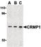 Collapsin Response Mediator Protein 1 antibody, LS-B483, Lifespan Biosciences, Western Blot image 
