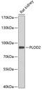 Procollagen-Lysine,2-Oxoglutarate 5-Dioxygenase 2 antibody, GTX64917, GeneTex, Western Blot image 