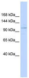 Suppression of tumorigenicity 18 protein antibody, TA334234, Origene, Western Blot image 