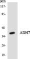 Alcohol Dehydrogenase 7 (Class IV), Mu Or Sigma Polypeptide antibody, LS-C200091, Lifespan Biosciences, Western Blot image 