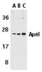TNF Superfamily Member 13 antibody, SP2133P, Origene, Western Blot image 