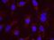 Enhancer Of MRNA Decapping 4 antibody, NB100-2273, Novus Biologicals, Proximity Ligation Assay image 
