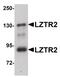 Protein transport protein Sec16B antibody, PA5-20903, Invitrogen Antibodies, Western Blot image 