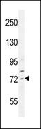 Sterol Regulatory Element Binding Transcription Factor 2 antibody, TA324363, Origene, Western Blot image 