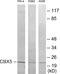 Chromobox 5 antibody, EKC1723, Boster Biological Technology, Western Blot image 