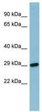 Retinol Binding Protein 4 antibody, TA346118, Origene, Western Blot image 