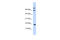 Putative uncharacterized protein encoded by NCRNA00257 antibody, 26-075, ProSci, Western Blot image 