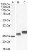 Casein Kinase 2 Beta antibody, orb318735, Biorbyt, Western Blot image 