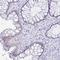 Chromosome 19 Open Reading Frame 73 antibody, NBP2-32367, Novus Biologicals, Immunohistochemistry frozen image 