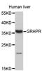 Glyoxylate reductase/hydroxypyruvate reductase antibody, STJ23857, St John