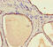 STAM-binding protein antibody, CSB-PA022794HA01HU, Cusabio, Immunohistochemistry paraffin image 