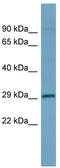 Homeobox D1 antibody, TA344560, Origene, Western Blot image 