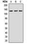 Calcium Voltage-Gated Channel Auxiliary Subunit Alpha2delta 3 antibody, LS-C668675, Lifespan Biosciences, Western Blot image 