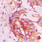 RHOH antibody, LS-C351843, Lifespan Biosciences, Immunohistochemistry frozen image 