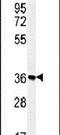 Solute Carrier Family 25 Member 28 antibody, PA5-25168, Invitrogen Antibodies, Western Blot image 