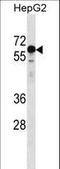 Kelch Like Family Member 25 antibody, LS-C165573, Lifespan Biosciences, Western Blot image 