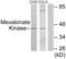 Mevalonate Kinase antibody, LS-C118984, Lifespan Biosciences, Western Blot image 