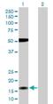 Zinc Finger Matrin-Type 4 antibody, H00079698-D01P, Novus Biologicals, Western Blot image 